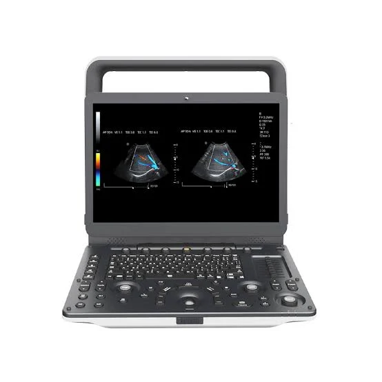 ECOGRAFO PORTATIL ZONCARE M30