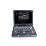 ECOGRAFO PORTATIL SIUI APOGEE 1000