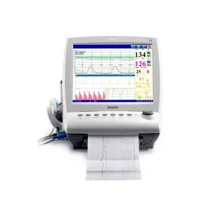 MONITOR FETAL GEMELAR
